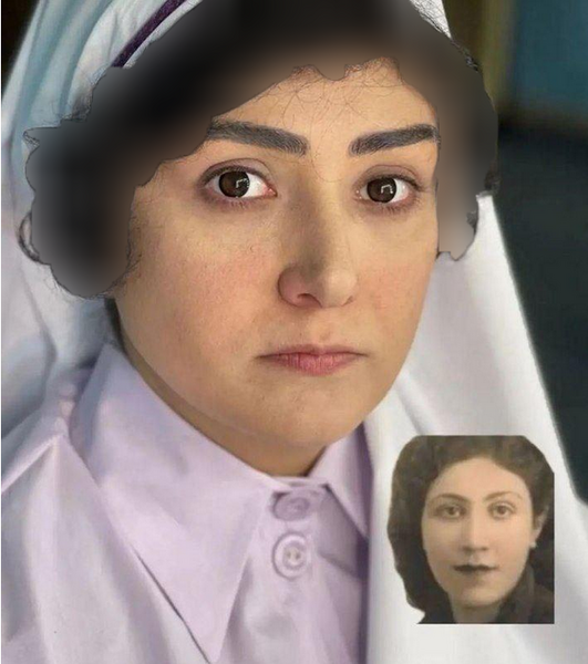 عکس باران کوثری قبل از عمل بینی