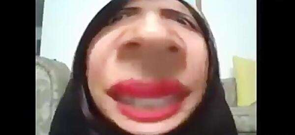 عکس نیکا فلاحی قبل از عمل صورت