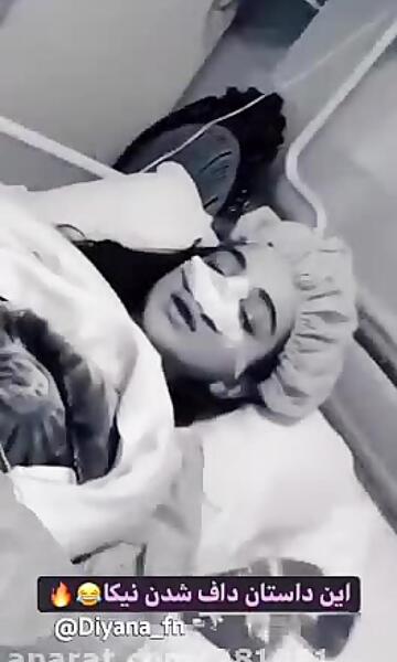 عکس نیکا فلاحی قبل از عمل صورت