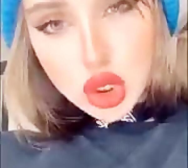 عکس نیکا فلاحی قبل از عمل صورت