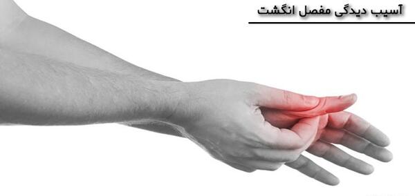 عکس ضرب دیدگی انگشت دست