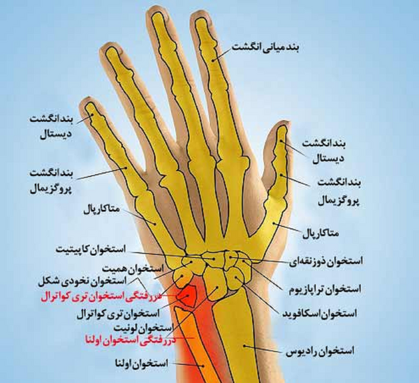 عکس ضرب دیدگی انگشت دست