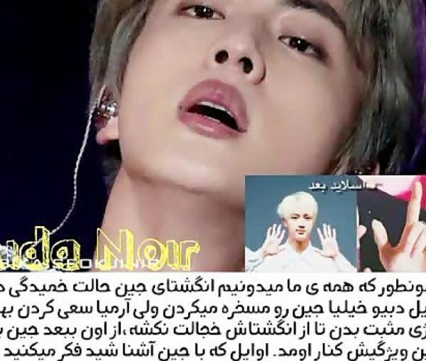 عکس یو جین بی تی اس