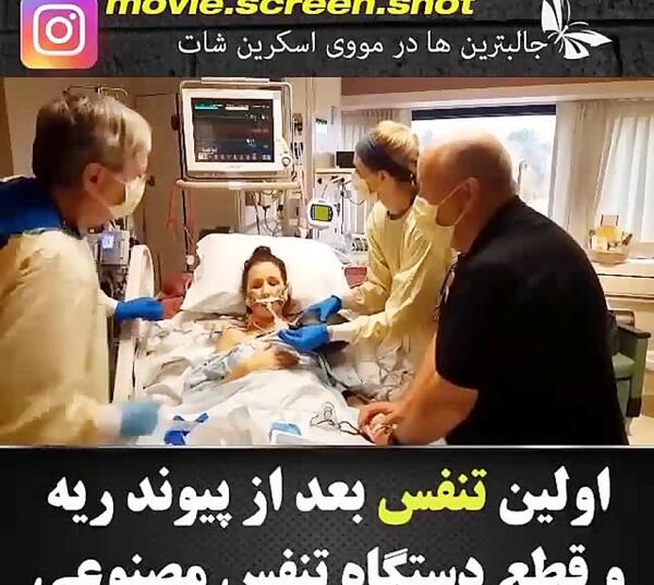 عکس پیوند ریه