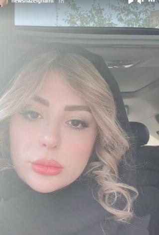 عکس فیک دختر دماغ عملی