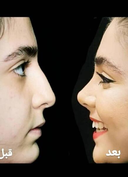 عکس فیک دختر دماغ عملی
