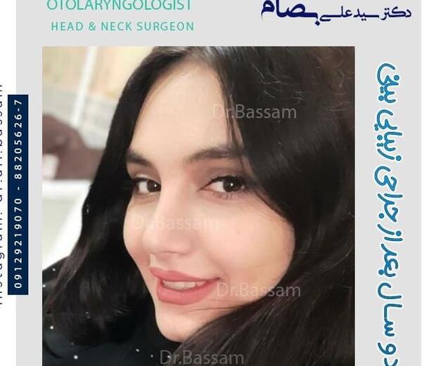 عکس فیک دختر دماغ عملی