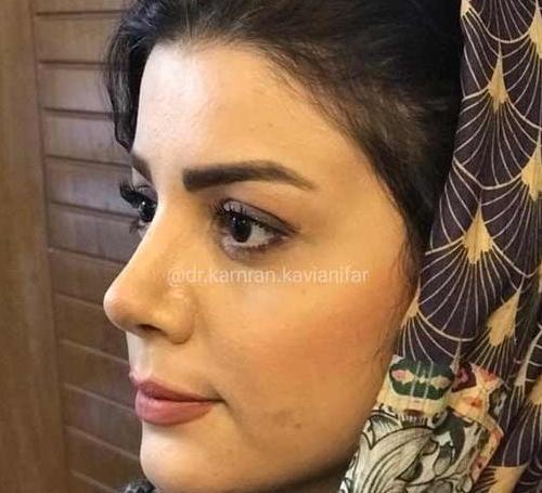 عکس فیک دختر دماغ عملی