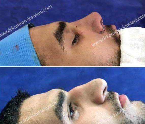 عکس فیک دختر دماغ عملی