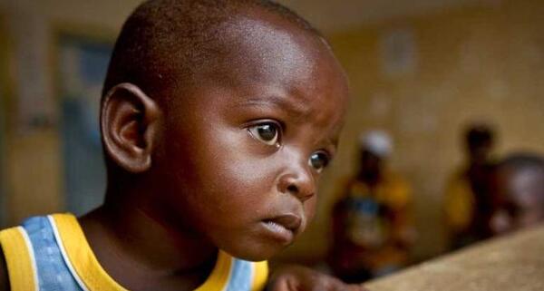 عکس سیاه پوست ترین نوزاد جهان