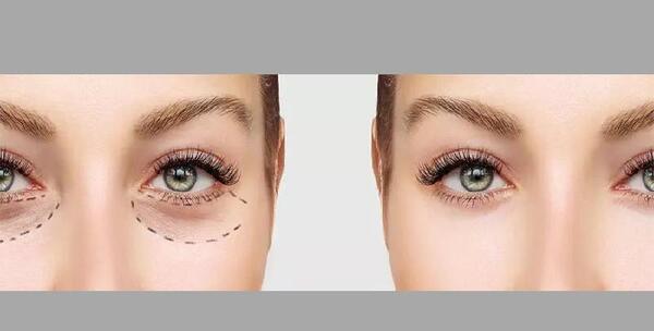 عکس چشم ژاپنی ها