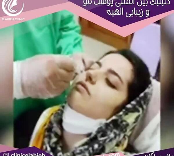 عکس آیو دی