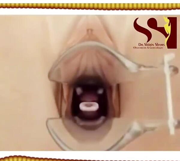 عکس آیو دی