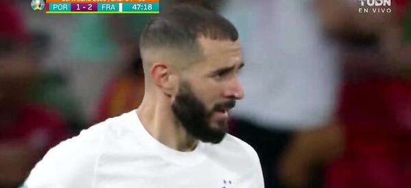 عکس امباپه کچل