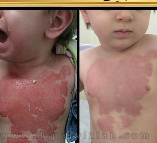 عکس نقاشی رو صورت بچه ها
