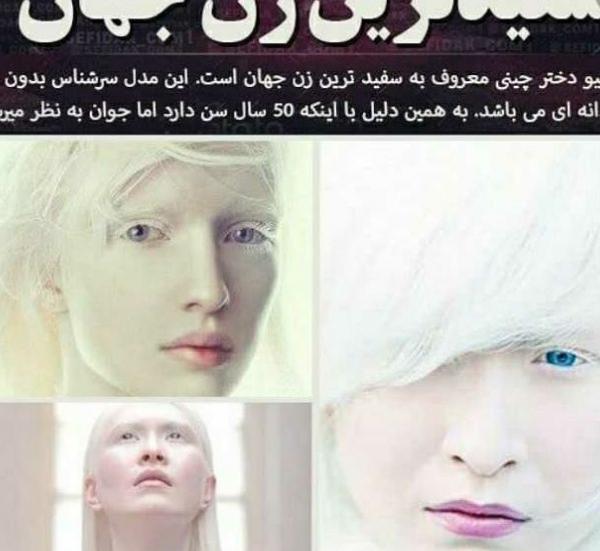 عکس سفید ترین آدم دنیا