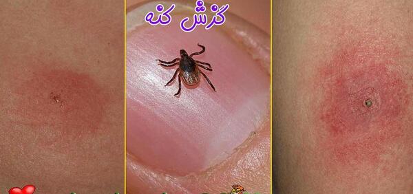 عکس کنه مرغی