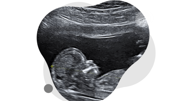 عکس ساده کلیه