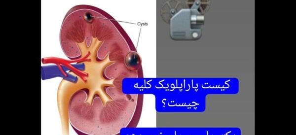 عکس ساده کلیه