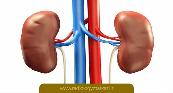 عکس ساده کلیه