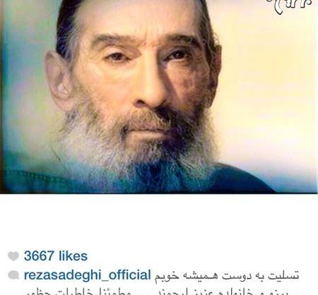 عکس الیزابت امینی قبل از عمل