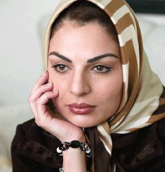 عکس الیزابت امینی قبل از عمل