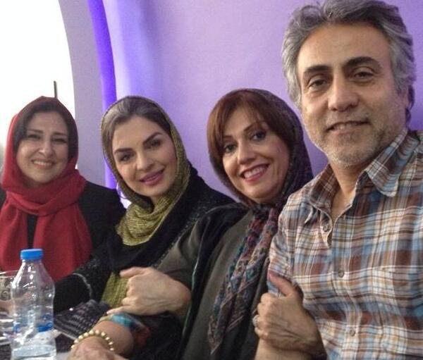 عکس الیزابت امینی قبل از عمل