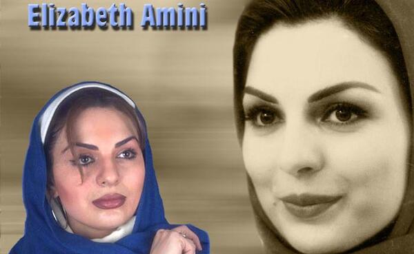 عکس الیزابت امینی قبل از عمل