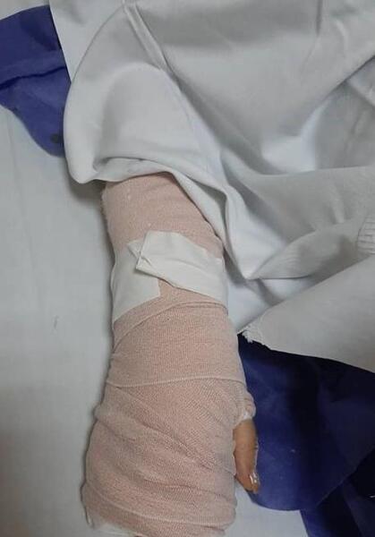 عکس فیک دست شکسته پسر
