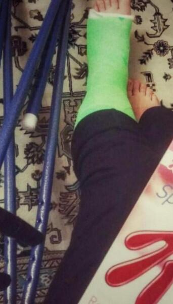 عکس فیک دست شکسته پسر