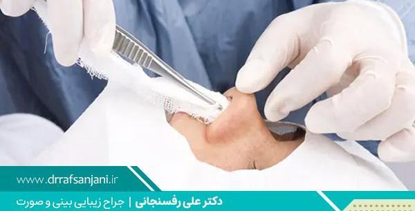 عکس تامپون بینی