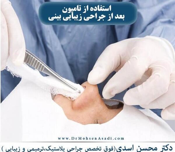 عکس تامپون بینی