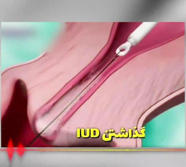 عکس دستگاه آیودی