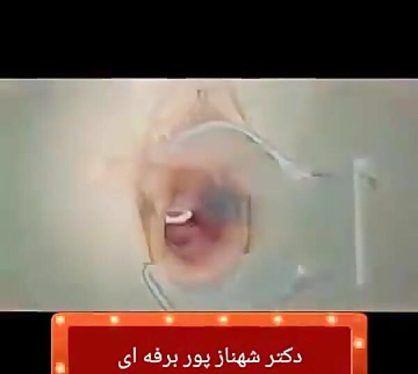عکس دستگاه آیودی