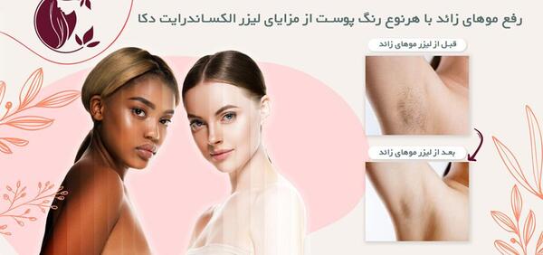 عکس دستگاه لیزر الکس دکا