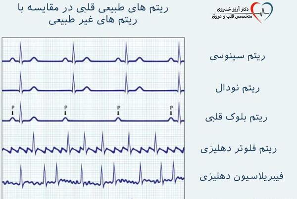 عکس لایه باز نوار قلب