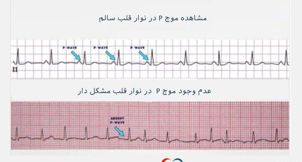 عکس لایه باز نوار قلب