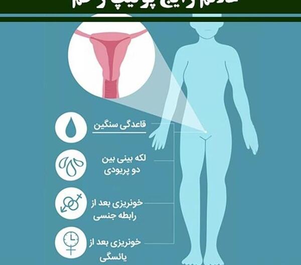 عکس پولیپ رحم