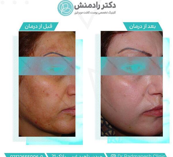 عکس قرمز شدن پوست