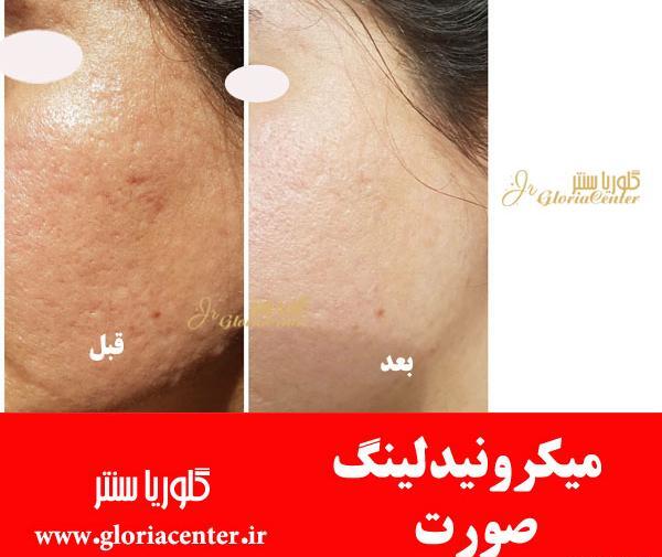 عکس قرمز شدن پوست