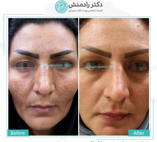 عکس قرمز شدن پوست