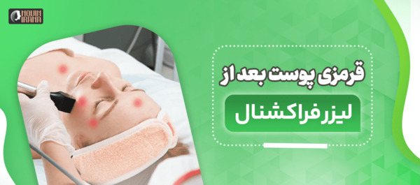 عکس قرمز شدن پوست