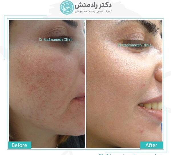 عکس قرمز شدن پوست