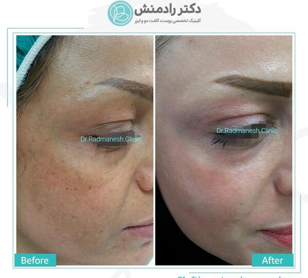 عکس قرمز شدن پوست