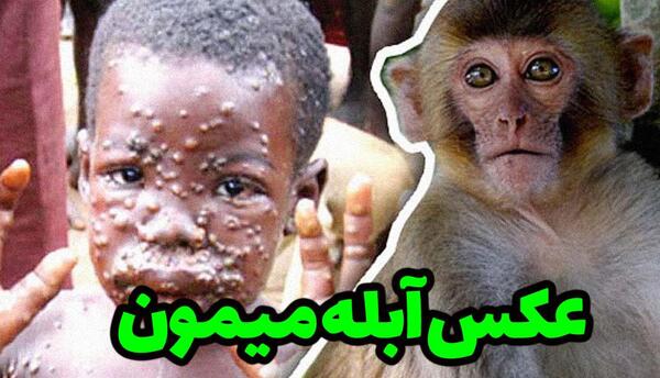 عکس دانه های آبله میمون