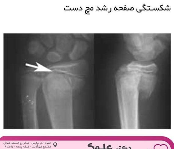 عکس تاتو نبض روی مچ دست