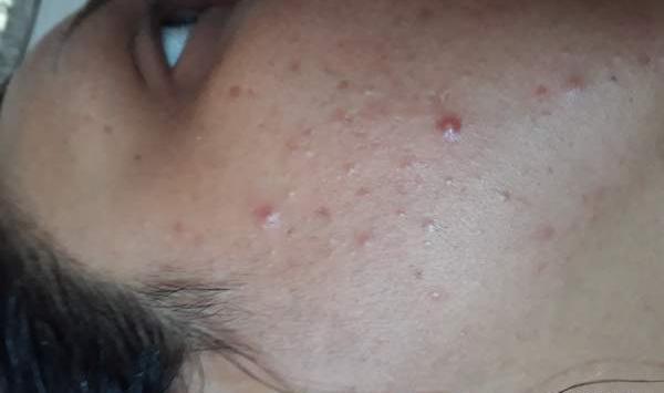عکس جوش نی نی سایت