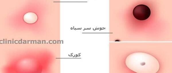 عکس جوش نی نی سایت