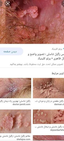 عکس جوش نی نی سایت