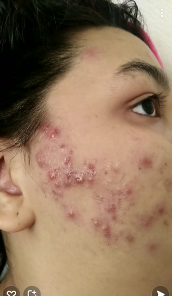 عکس جوش نی نی سایت